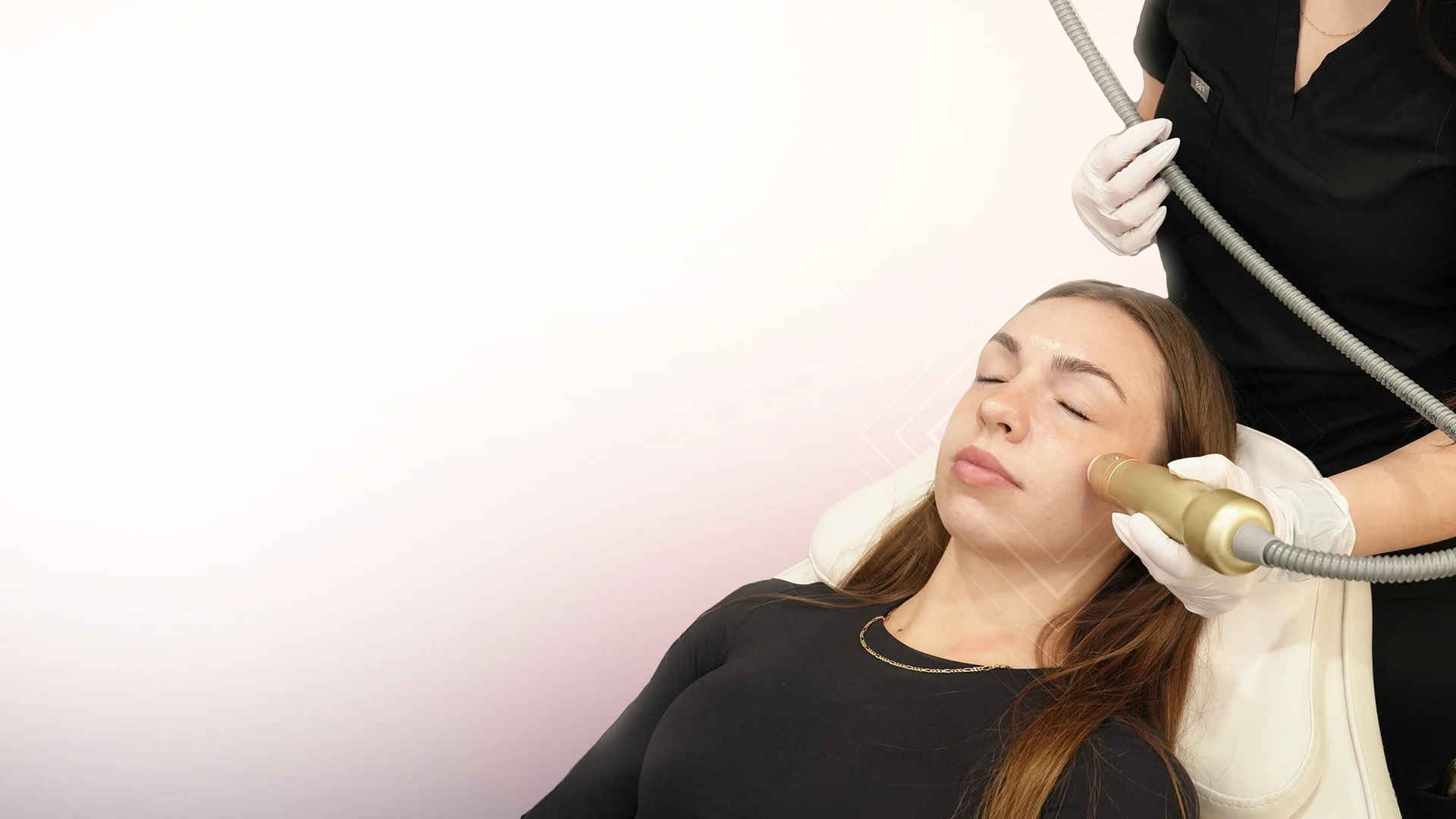 RF Microneedling – Sylfirm X treatment at Toronto medical spa - Treat Skin Laxity, Scars, Redness & Texture With Precision RF Energy...